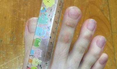 पिछले कईं दिनों से सोशल मीडिया पर कुछ फोटो वायरल हो रही हैं। जिसमें एक लड़की पैर की उंगलियों को दिखा रही है। 