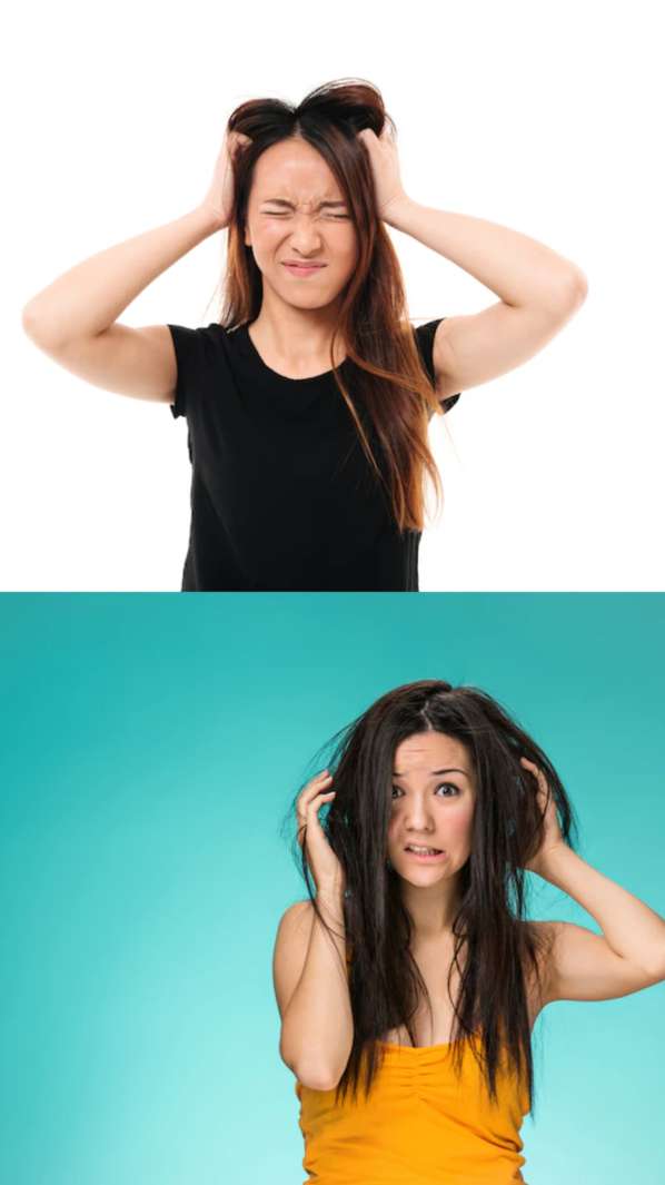 Hair Care Tips home remedies for dandruff itchy scalp problem in winter - India TV Hindi Hair Care Tips home remedies for dandruff itchy scalp problem in winter - India TV Hindi