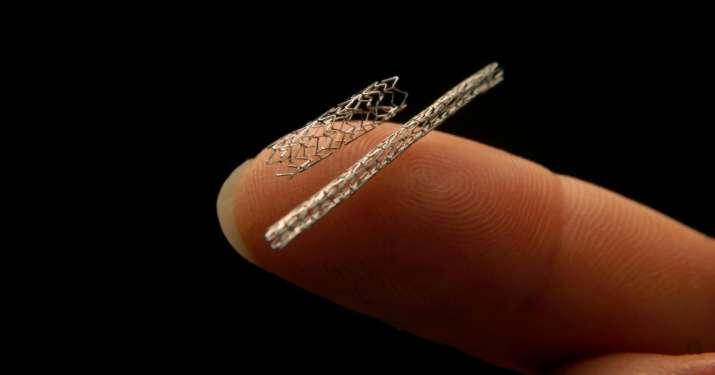stents price by NPAA stents price by NPAA - India TV Paisa