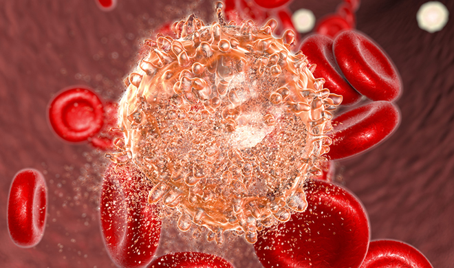 Prostate cancer in detail in hindi: सावधान! शरीर में दिखे इस तरह के लक्षण तो हो सकता है प्रोस्टेट कैंसर - India TV Hindi News