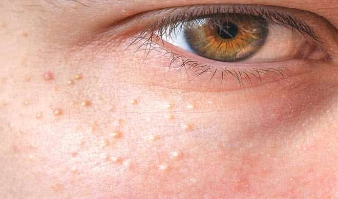 skin problem skin problem- India TV Hindi