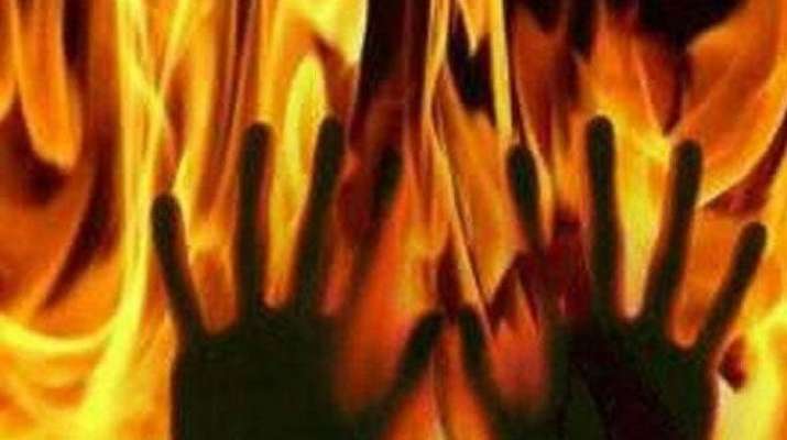 burnt alive burnt alive- India TV Hindi