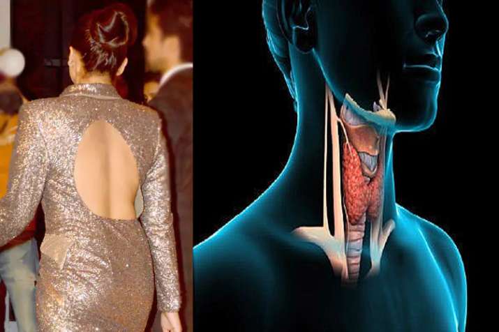 health problem health problem- India TV Hindi