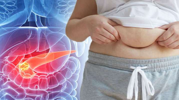Pancreatic Cancer Pancreatic Cancer- India TV