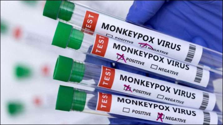 Monkeypox से संक्रमित होने का शक, शख्स को अस्पताल में कराया गया एडमिट