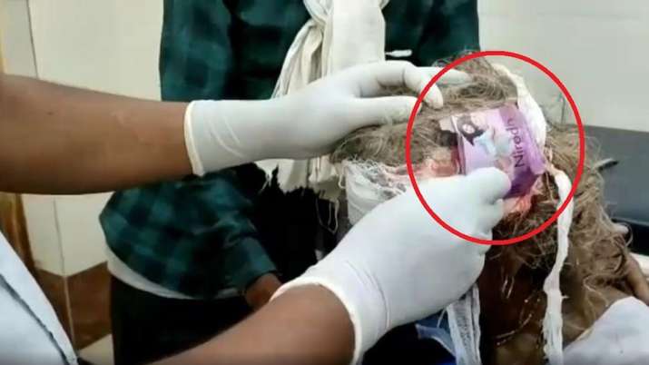 महिला के सिर पर था घाव, कंडोम का रेपर लगाकर बांध दी पट्टी, जांच का आदेश