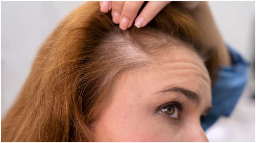 Anda harus menerapkan paket rambut ini pada rambut dan kulit kepala Anda. Untuk hasil yang lebih baik, simpan masker rambut ini selama kurang lebih setengah jam. Setelah 30 menit, Anda bisa mencuci rambut dengan sampo ringan. Anda harus menerapkan paket rambut ini pada rambut dan kulit kepala Anda. Untuk hasil yang lebih baik, simpan masker rambut ini selama kurang lebih setengah jam. Setelah 30 menit, Anda bisa mencuci rambut dengan sampo ringan.