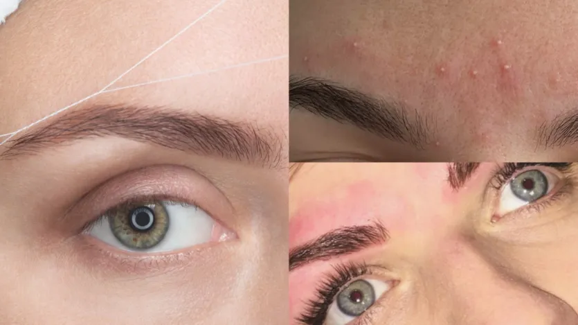 As mulheres costumam reclamar de coceira e irritação ao redor das sobrancelhas após as sobrancelhas. Muitas vezes sua vermelhidão é vista separadamente. Em tal situação, se você cuidar de algumas coisas após as sobrancelhas, poderá evitar esse tipo de desconforto. Vamos saber o que fazer e o que não fazer depois de Ibro Threading? As mulheres costumam reclamar de coceira e irritação ao redor das sobrancelhas após as sobrancelhas. Muitas vezes sua vermelhidão é vista separadamente. Em tal situação, se você cuidar de algumas coisas após as sobrancelhas, poderá evitar esse tipo de desconforto. Vamos saber o que fazer e o que não fazer depois de Ibro Threading?