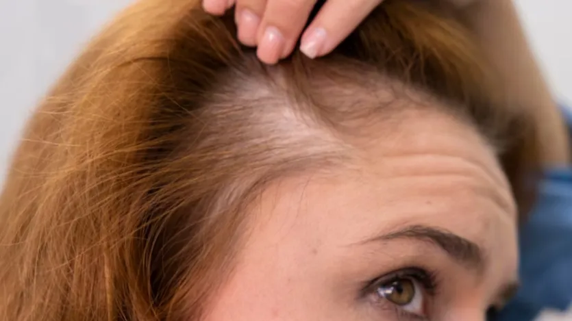 As pessoas que estão lutando com os cortes de cabelo do penteado não devem envolver as toalhas nos cabelos. Os cabelos fracos podem ser quebrados puxando as toalhas nos cabelos. Em tal situação, muitos cabelos saudáveis também se dividem nas toalhas e quebra. Ao fazer isso, o cabelo começa a secar rapidamente e a brilha natural do cabelo é brilhada. As pessoas que estão lutando com os cortes de cabelo do penteado não devem envolver as toalhas nos cabelos. Os cabelos fracos podem ser quebrados puxando as toalhas nos cabelos. Em tal situação, muitos cabelos saudáveis também se dividem nas toalhas e quebra. Ao fazer isso, o cabelo começa a secar rapidamente e a brilha natural do cabelo é brilhada.