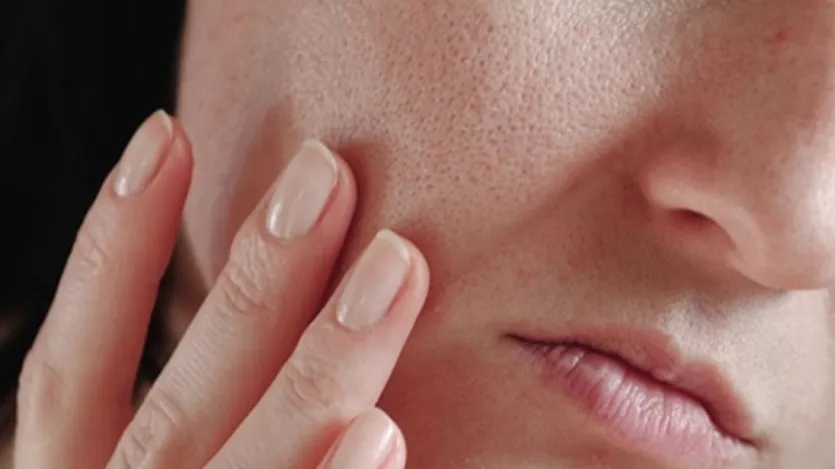 A desidratação e o calor podem causar estragos na pele. Os compostos anti-inflamatórios e antioxidantes desta foto ajudam a reduzir as espinhas, acalmar os danos causados pelo sol e promover o brilho natural por dentro. A desidratação e o calor podem causar estragos na pele. Os compostos anti-inflamatórios e antioxidantes desta foto ajudam a reduzir as espinhas, acalmar os danos causados pelo sol e promover o brilho natural por dentro.