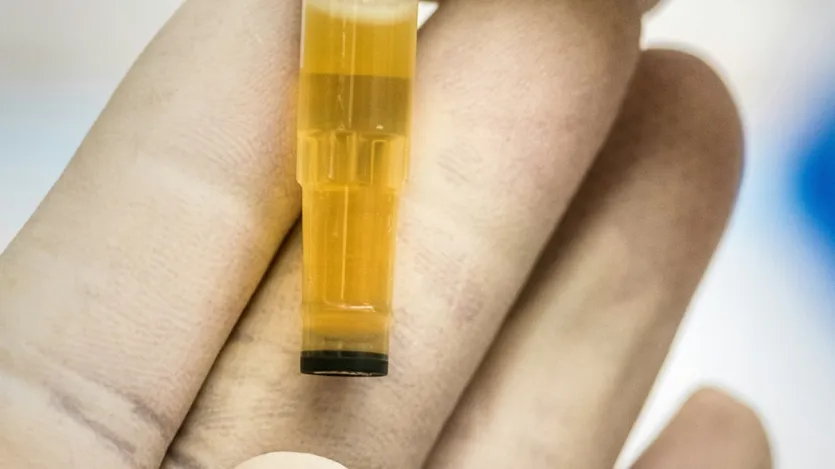 पेशाब करने में कठिनाई: जैसे-जैसे बीमारी बढ़ती है, पेशाब करते समय जलन, बार-बार पेशाब आना या पेशाब करने में कठिनाई हो सकती है। कुछ महिलाओं को लगातार थकान, वजन कम होना और भूख न लगना जैसी समस्याएं भी महसूस होती हैं। ये सभी लक्षण इस बात का संकेत हो सकते हैं कि कैंसर शरीर को प्रभावित कर रहा है।