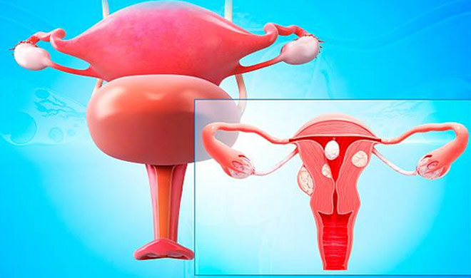 Ovarian Cancer Ovarian Cancer- India TV Hindi
