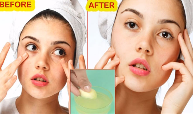 Skin Skin- India TV Hindi