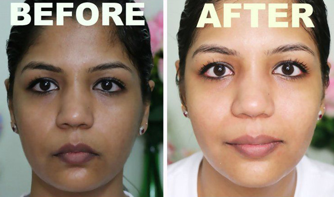 fair skin fair skin- India TV Hindi