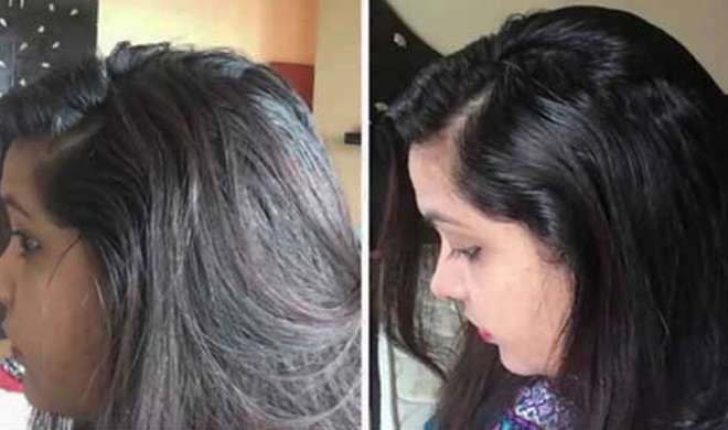 grey hair grey hair- India TV Hindi