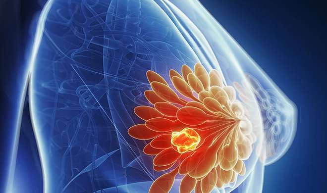 breast cancer breast cancer- India TV Hindi