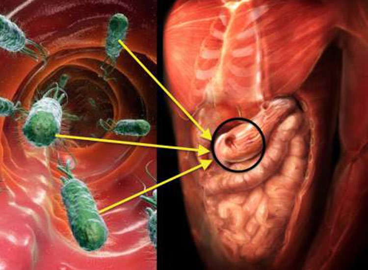 Gut bacteria control cancer immunity in the liver Gut bacteria control cancer immunity in the liver- India TV Hindi