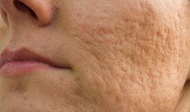 skin pores skin pores- India TV Hindi