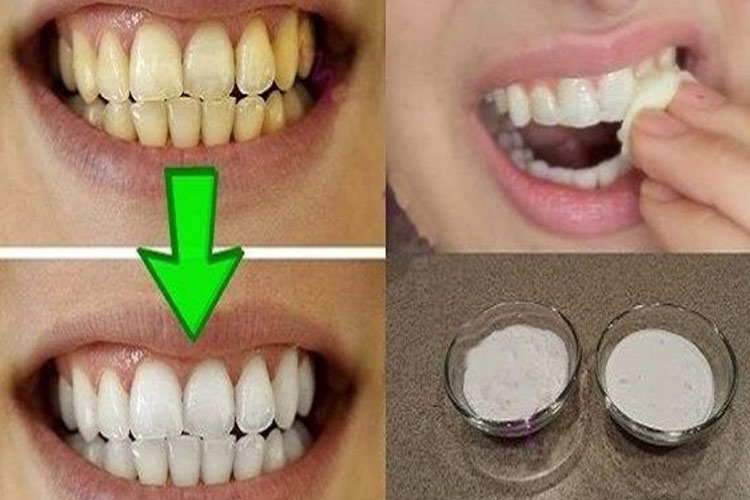 Teeth Teeth- India TV Hindi