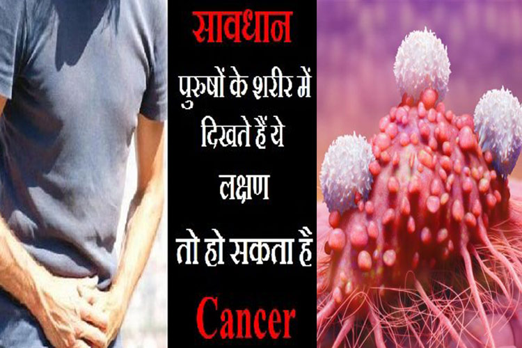 Cancer Cancer- India TV Hindi