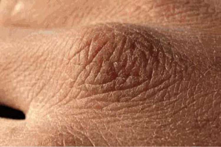 skin problem skin problem- India TV Hindi