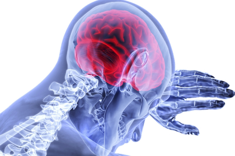 Brain Hemorrhage Brain Hemorrhage- India TV Hindi