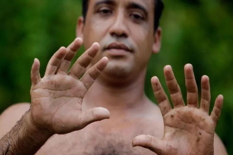 6 fingers per hand are better than 5 says research 6 fingers per hand are better than 5 says research - India TV Hindi