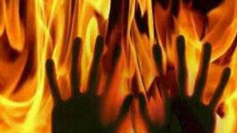 burnt burnt- India TV Hindi