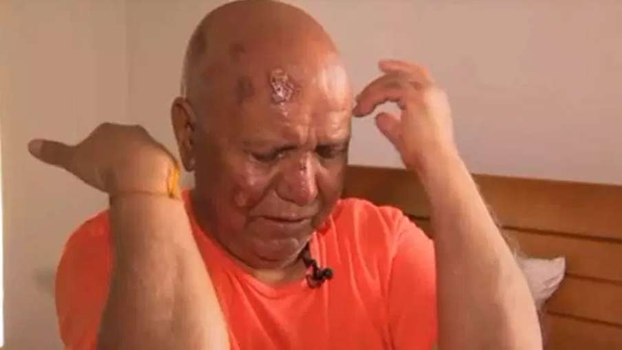 Hindu priest Harish Chander Puri attacked near temple in US | Videograb/PIX 11 news Hindu priest Harish Chander Puri attacked near temple in US | Videograb/PIX 11 news- India TV Hindi