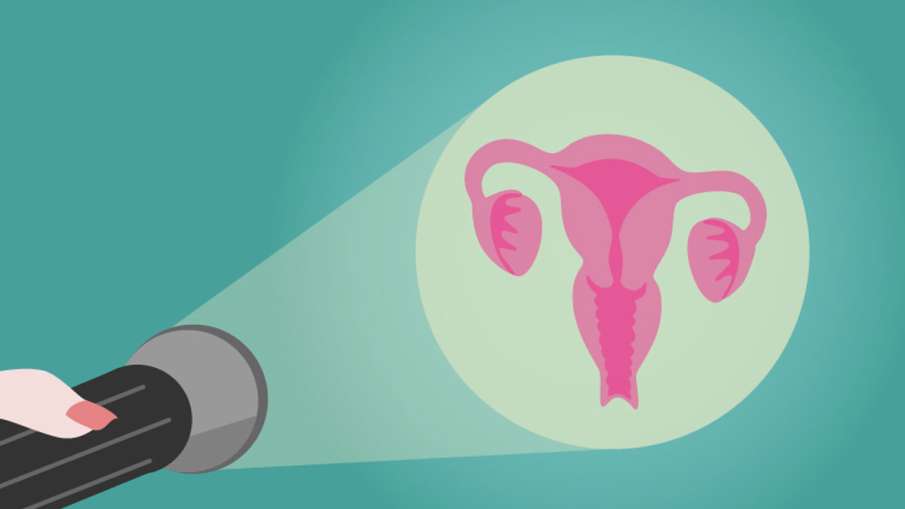 cervical cancer cervical cancer - India TV Hindi