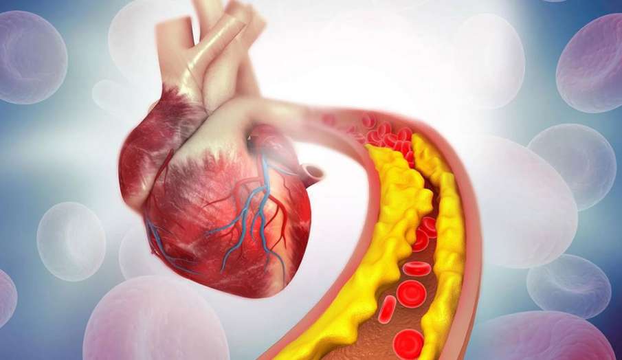high cholesterol high cholesterol - India TV Hindi