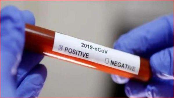 Pakistan's coronavirus tally rises to 34 Pakistan's coronavirus tally rises to 34- India TV Hindi