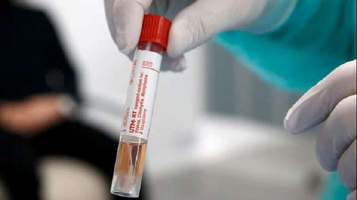 coronavirus coronavirus- India TV Hindi