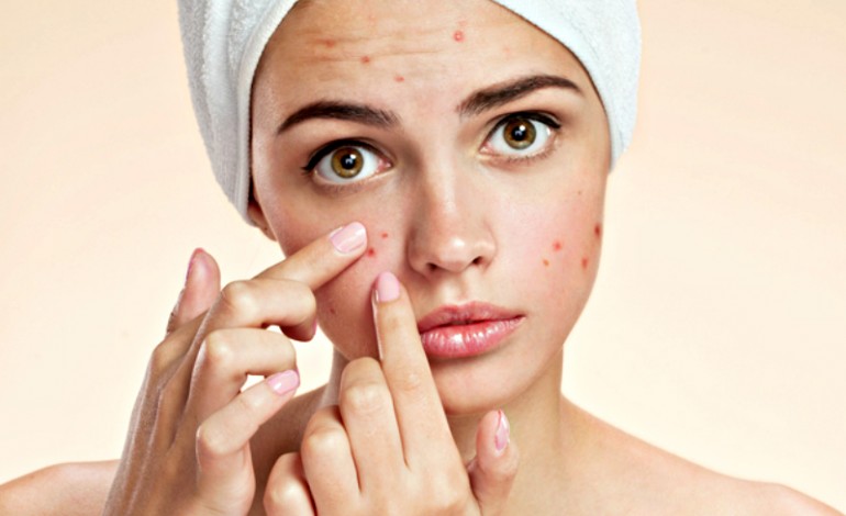 Acne Acne - India TV Hindi