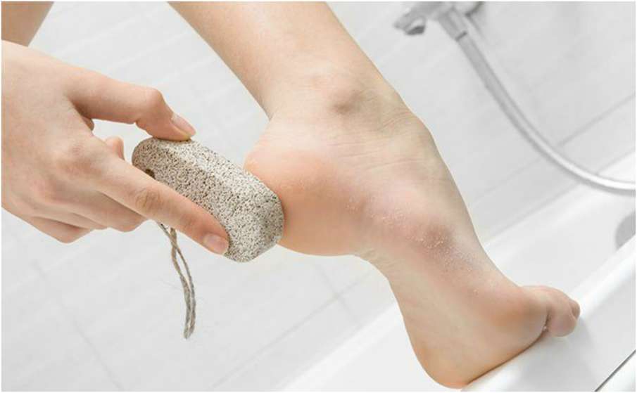 cracked heels cracked heels- India TV Hindi