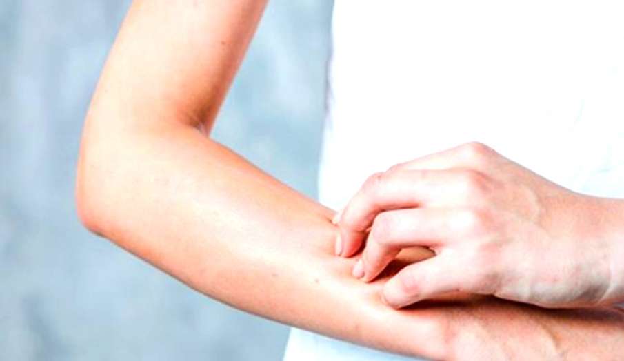 skin itching problems skin itching problems- India TV Hindi