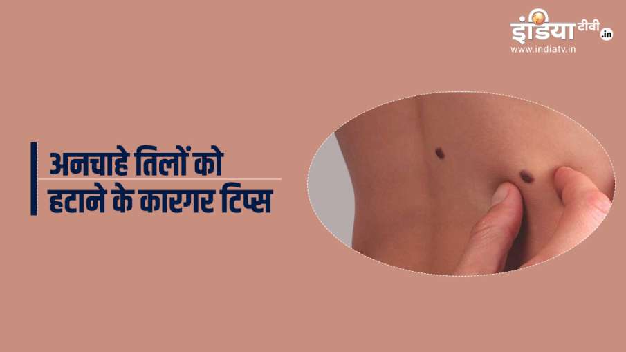tips for mole tips for mole - India TV Hindi