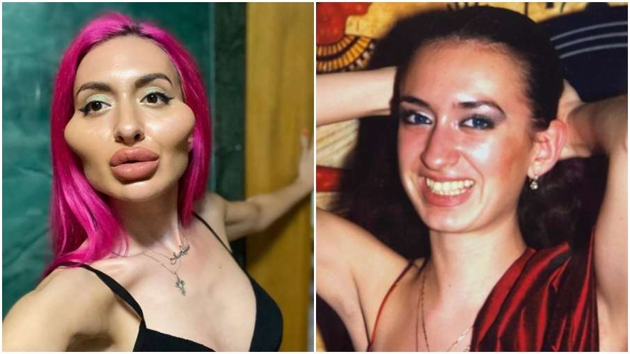 woman with worlds biggest cheeks said how people abuse her on social media - दुनिया की 'सबसे बड़े गा woman with worlds biggest cheeks said how people abuse her on social media - दुनिया की 'सबसे बड़े गा- India TV Hindi