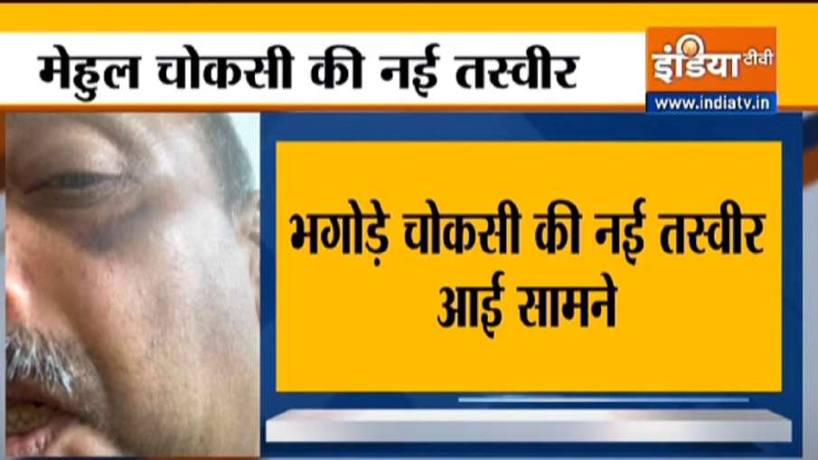 Mehul Choksi new image injury on eye face hand मेहुल चोकसी की नई तस्वीर आई सामने, मुंह पर भी दिख रहे Mehul Choksi new image injury on eye face hand मेहुल चोकसी की नई तस्वीर आई सामने, मुंह पर भी दिख रहे- India TV Hindi