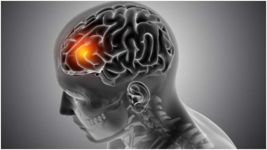 brain tumor brain tumor- India TV Hindi