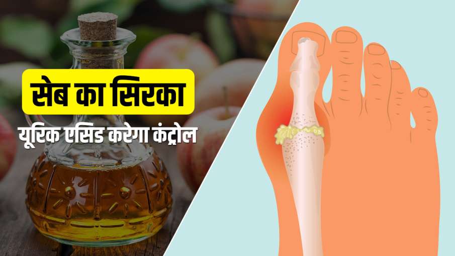 Apple Vinegar control Uric Acid Apple Vinegar control Uric Acid- India TV Hindi