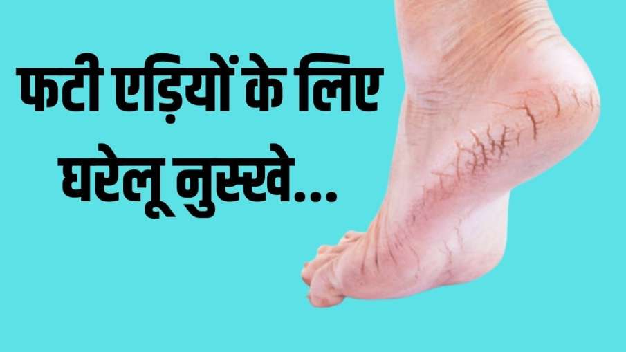 heel repair heel repair- India TV Hindi