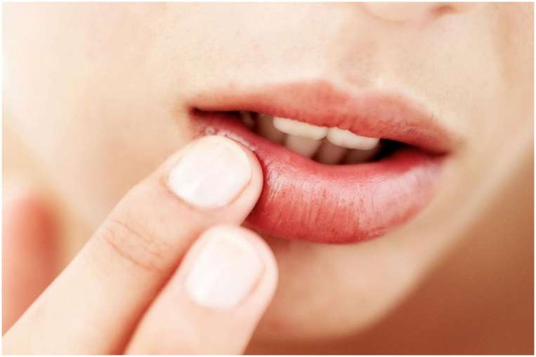 Home Remedy For Dry Lips- India TV Hindi News