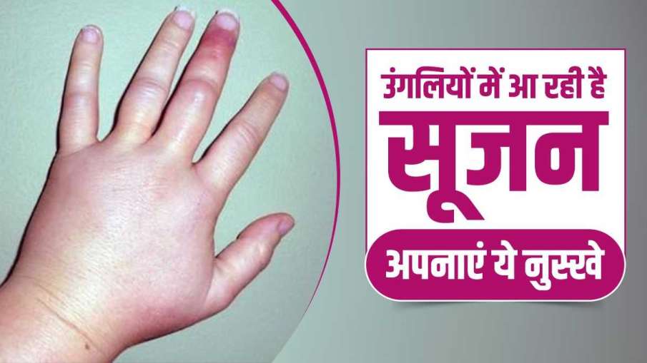 उंगलियों में आ रही है सूजन अपनाएं ये नुस्खे- India TV Hindi