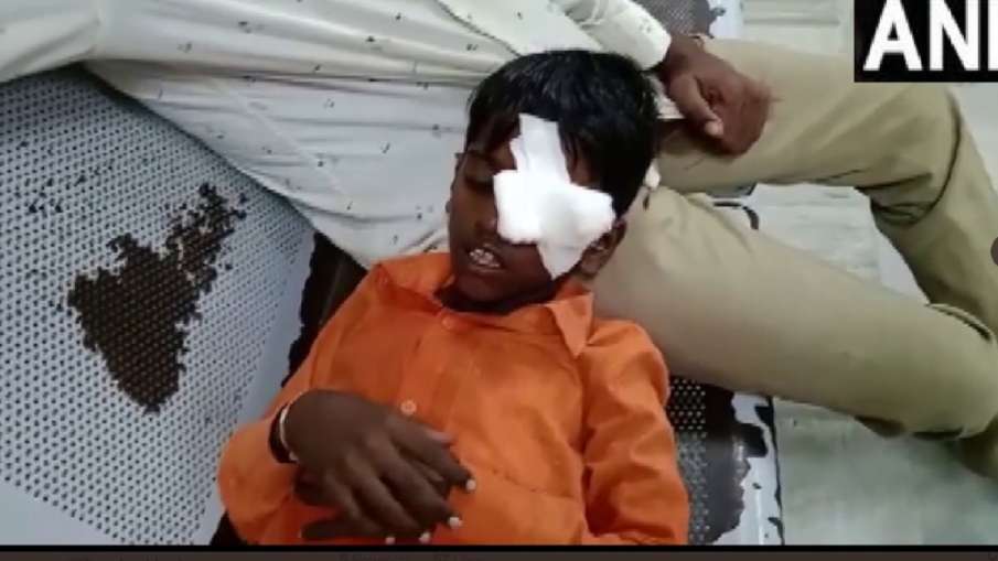 Child injured while lighting firecrackers- India TV Hindi News
