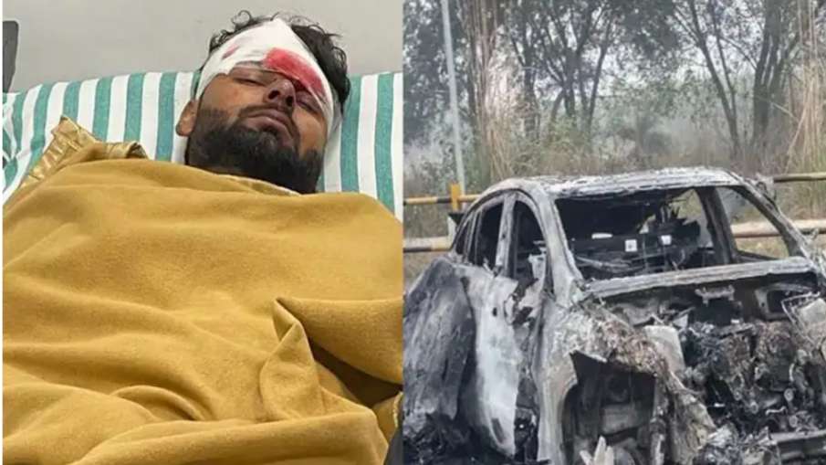 Rishabh Pant, Health Update, Car Accident- India TV Hindi