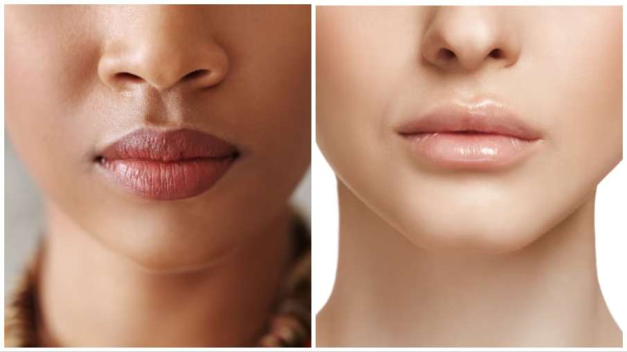 your lip colour say about your health- India TV Hindi
