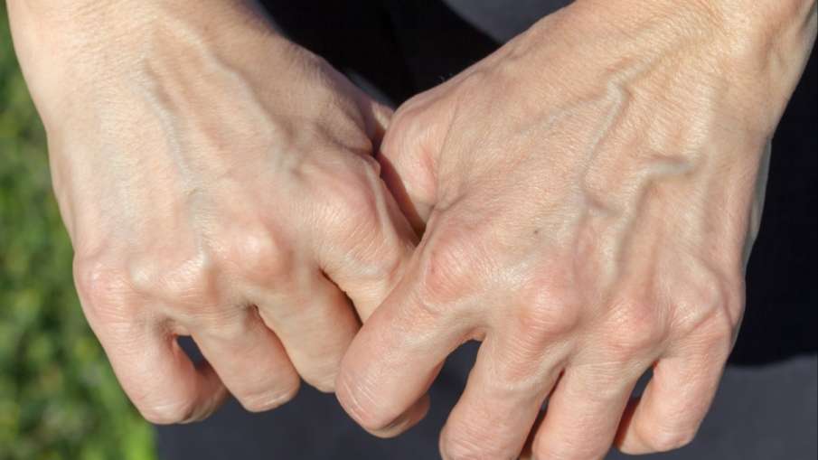 causes of sudden prominent blue veins - India TV Hindi